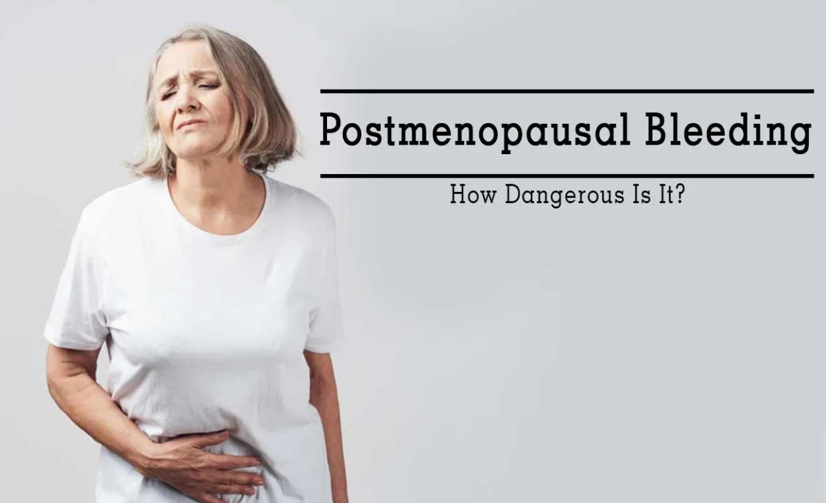 private_sono's tweet image. Postmenopausal Bleeding - How Dangerous Is It?
Postmenopausal bleeding (PMB) is vaginal bleeding occurring after a woman has gone through menopause, defined as 12 consecutive months without a menstrual period. #PCOS #PelvicScan #PelvicUltrasound

londonsono.com/postmenopausal…