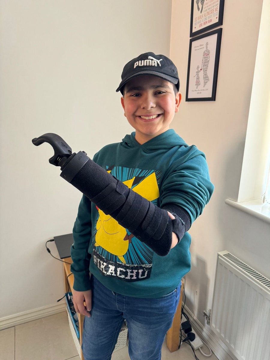 Absolutely fantastic to see 12 year old Rian being able to cycle again with his new adapted CFC bike and a @KoalaaCommunity handlebar attachment. Rian was diagnosed with rhabdomyosarcoma in 2023 after swelling developed in his left hand. He had a partial amputation of the hand,