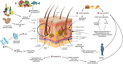 The article 'Assessing dietary considerations in hidradenitis suppurativa: a critical examination of existing knowledge' authored by Assoc. Prof. Seçil Vural, Department of Dermatology at the School of Medicine, and her team investigate how diet might affect the progression of a…