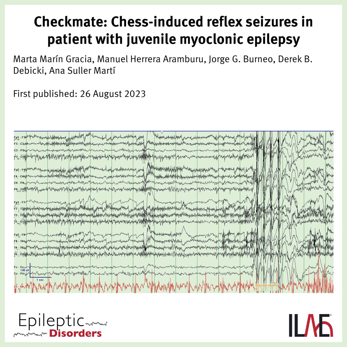 'Reflex seizures are unusual & consistently evoked by specific stimulus. RS occur in the setting of focal or generalized epilepsy but are historically related to idiopathic generalized epilepsy, especially juvenile myoclonic #epilepsy...' @EpiDisorders: doi.org/10.1002/epd2.2…