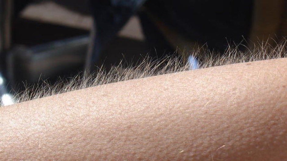 [ Mini Thread ] 

Les buts de l’OL qui font cet effet 

#TeamOL ❤️💙