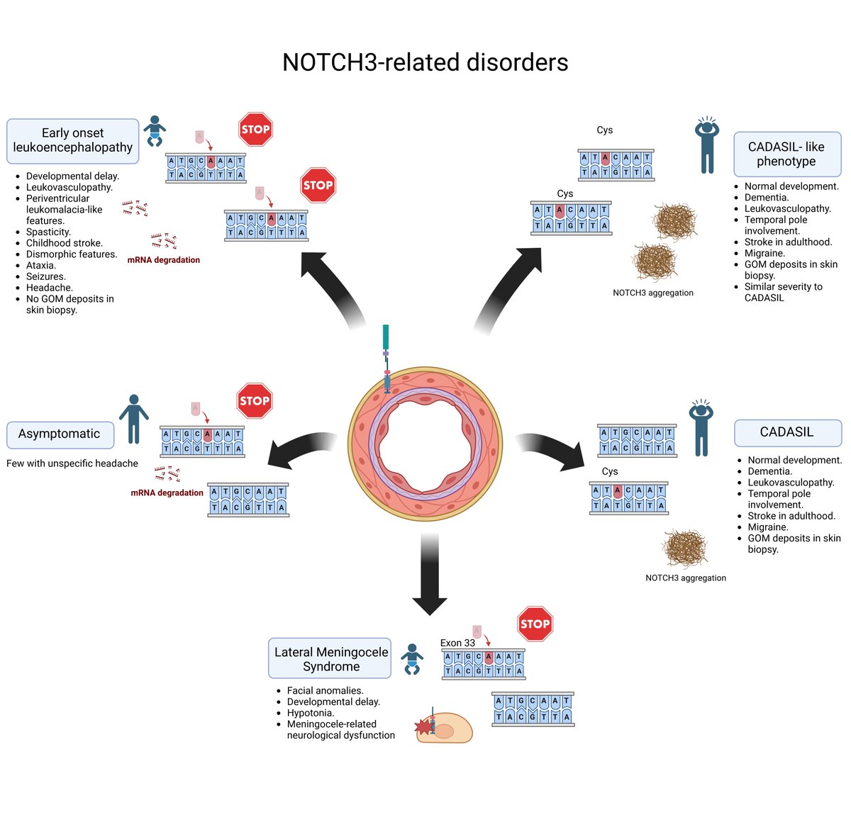 Our preprints with @TheLancet unveil biallelic NOTCH3 variants: truncating ones cause neurodevelopmental disorder, while cysteine missense resemble CADASIL. Missense carriers exhibit CADASIL; truncating carriers are mostly asymptomatic unless affecting last exon, leading to LMS.