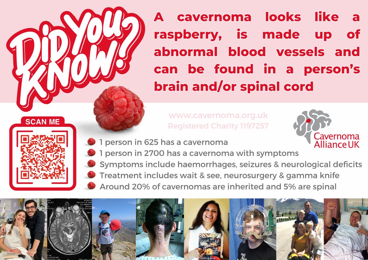 We’re really pleased to share our new #cavernoma ‘Key Facts’ poster. We would absolutely love it if you can print and display, helping to raise much needed awareness. To download your copy, go to bit.ly/CAUKKeyFactsPo…. #BrainAwarenessWeek.