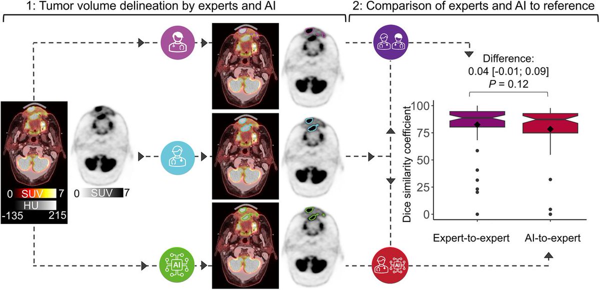 Clinical evaluation of deep learning for tumor delineation on 18F-FDG PET/CT of #HeadandNeckCancer. ow.ly/pAtC50QHZNr #NuclearMedicine #ArtificialIntelligence @davidkvcs