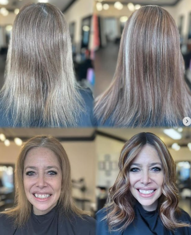 Ann, facing stage 4 breast cancer, bravely battles on. 🎗️✨
#uniwigs #hairpatch #thinninghair #finehairstyles #hairloss #alternativehair #helperhair #hairtransformation #BreastCancerAwareness #HairHope #strengthandbeauty