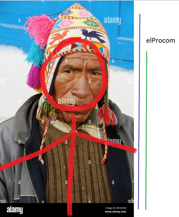 Buenos días a todos, excepto, a los que las balas duelen poco 😔