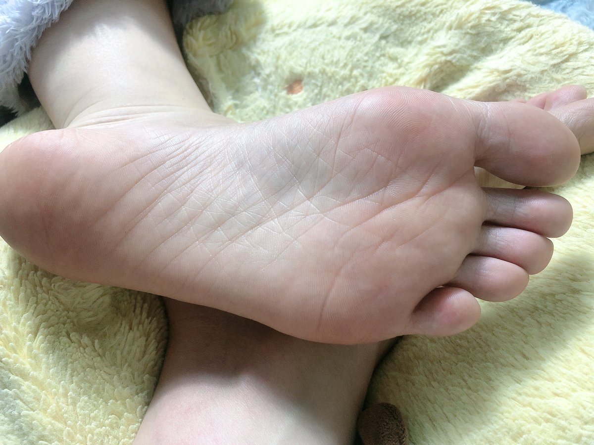linglingya520's tweet photo. 回南天，黏糊糊的，还好我的jio没有。#足交 #美脚 #调教 #玉足 #裸足 https://t.co/iLaq0c9TLr