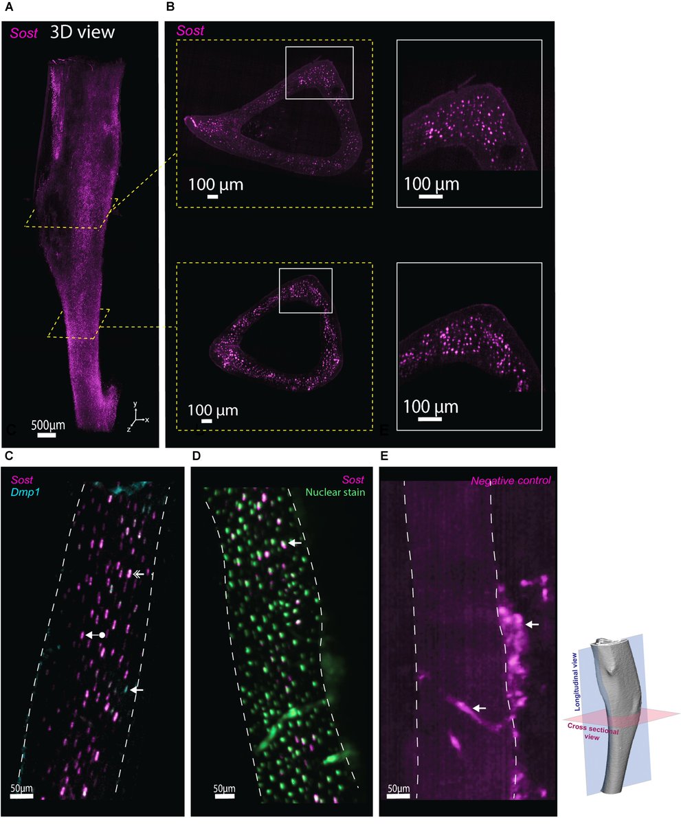 Quentin Meslier (@meslier_q) on Twitter photo Excited to share our new method preprint, WISH-BONE, to label osteocyte mRNA and protein in 3D mouse bone, presented at #ORS2024.
Collaboration between ShefelbineLab, <a href="/monaghan_lab/">Monaghan Lab</a>, and <a href="/LifeCanvasTech/">LifeCanvas Technologies</a>. Stay tuned for videos! biorxiv.org/content/10.110…
<a href="/ORSsociety/">Orthopaedic Research Society</a>, <a href="/NUBioE1/">Northeastern University Bioengineering</a> Excited to share our new method preprint, WISH-BONE, to label osteocyte mRNA and protein in 3D mouse bone, presented at #ORS2024.
Collaboration between ShefelbineLab, <a href="/monaghan_lab/">Monaghan Lab</a>, and <a href="/LifeCanvasTech/">LifeCanvas Technologies</a>. Stay tuned for videos! biorxiv.org/content/10.110…
<a href="/ORSsociety/">Orthopaedic Research Society</a>, <a href="/NUBioE1/">Northeastern University Bioengineering</a>