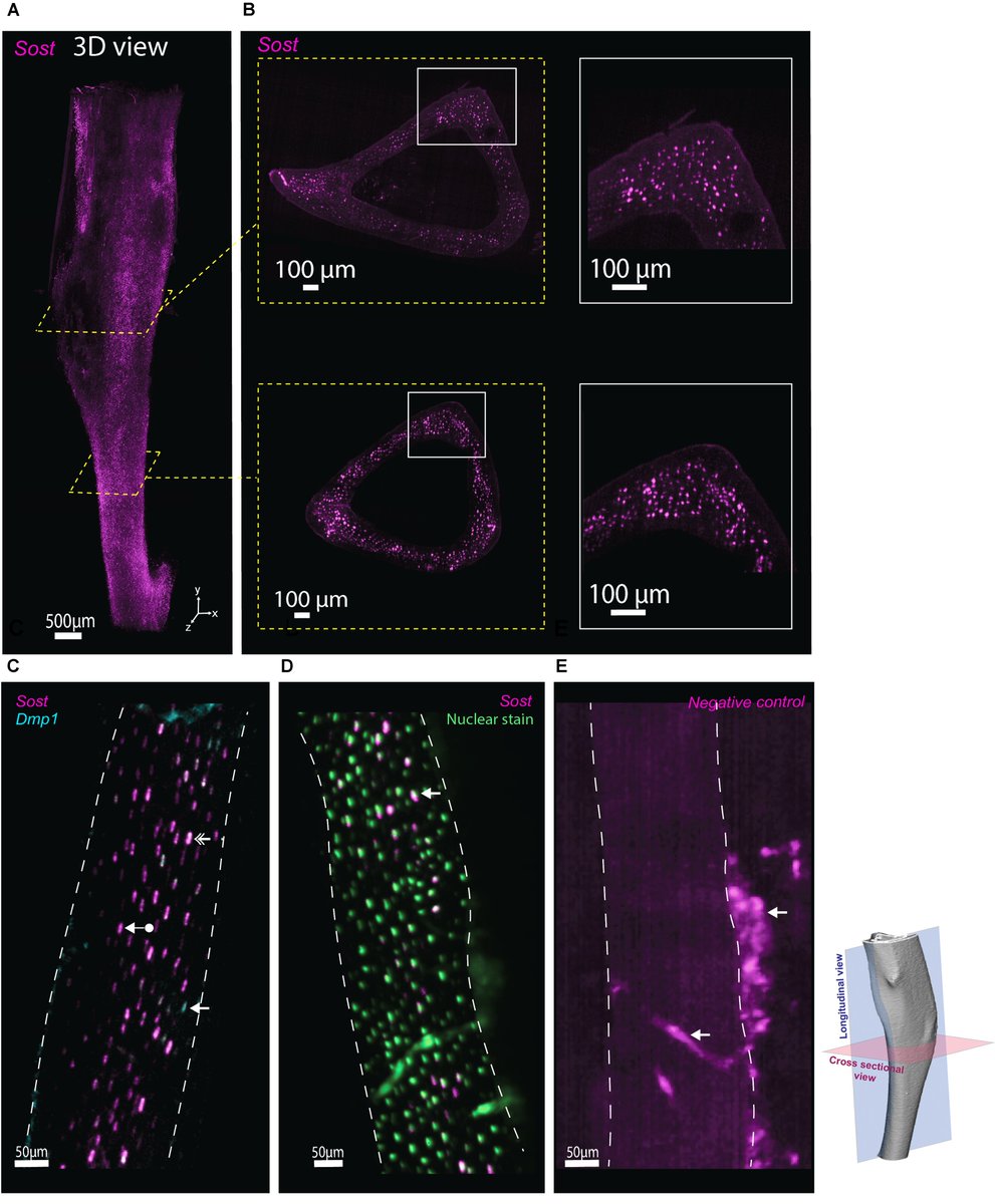 Excited to share our new method preprint, WISH-BONE, to label osteocyte mRNA and protein in 3D mouse bone, presented at #ORS2024. Collaboration between ShefelbineLab, @monaghan_lab, and @LifeCanvasTech. Stay tuned for videos! biorxiv.org/content/10.110… @ORSsociety, @NUBioE1