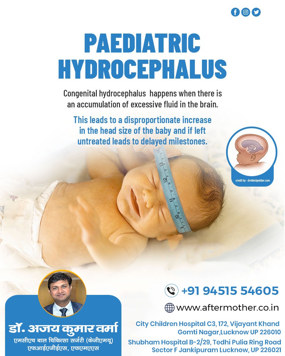 DrAjayKumarVer6's tweet photo. Pediatric Hydrocephalus...
Hydrocephalus is the accumulation of too much fluid in the brain and spinal cord. 
#hydrocephalus #hydrocephalusawareness
.
📆 For more information contact us:
Dr Ajay Kumar Verma
(Pediatric Surgeon)
📞 9451554605 https://t.co/I82onQxGmI