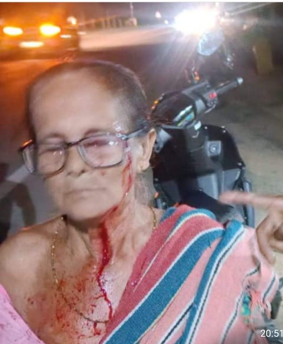 Encouraged by the fiery speeches of BJP candidate of W. Tripura C'tuency n the leader of their new ally, h'brid workers are not sparing even octogenarian 2wards the attempt of silencing the opposition voice. Milanbala Deb(80) got seriously injured today at M'pur under Sidhai P.S.