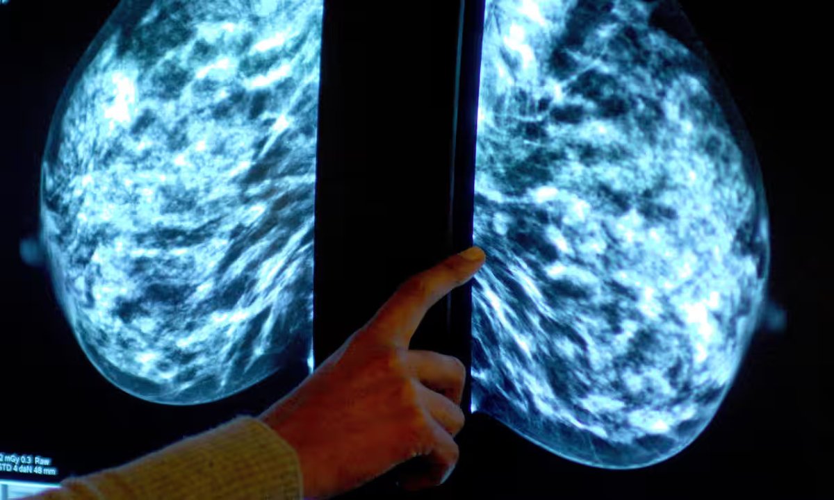 NHS SNEE ICB - Ipswich and east Suffolk (@sneeicb_ies) on Twitter photo UK scientists working on breast cancer monitor fitted in bra in hope device used at home will improve tracking of tumours.
ow.ly/WU6P50QVJi6
<a href="/CSSuffolk/">Cancer Support Suffolk</a> <a href="/ESNEFT/">East Suffolk and North Essex NHS Foundation Trust</a> <a href="/SCCPublicHealth/">Healthy Suffolk</a> <a href="/EoE_cancer/">East of England Cancer Alliance</a> UK scientists working on breast cancer monitor fitted in bra in hope device used at home will improve tracking of tumours.
ow.ly/WU6P50QVJi6
<a href="/CSSuffolk/">Cancer Support Suffolk</a> <a href="/ESNEFT/">East Suffolk and North Essex NHS Foundation Trust</a> <a href="/SCCPublicHealth/">Healthy Suffolk</a> <a href="/EoE_cancer/">East of England Cancer Alliance</a>