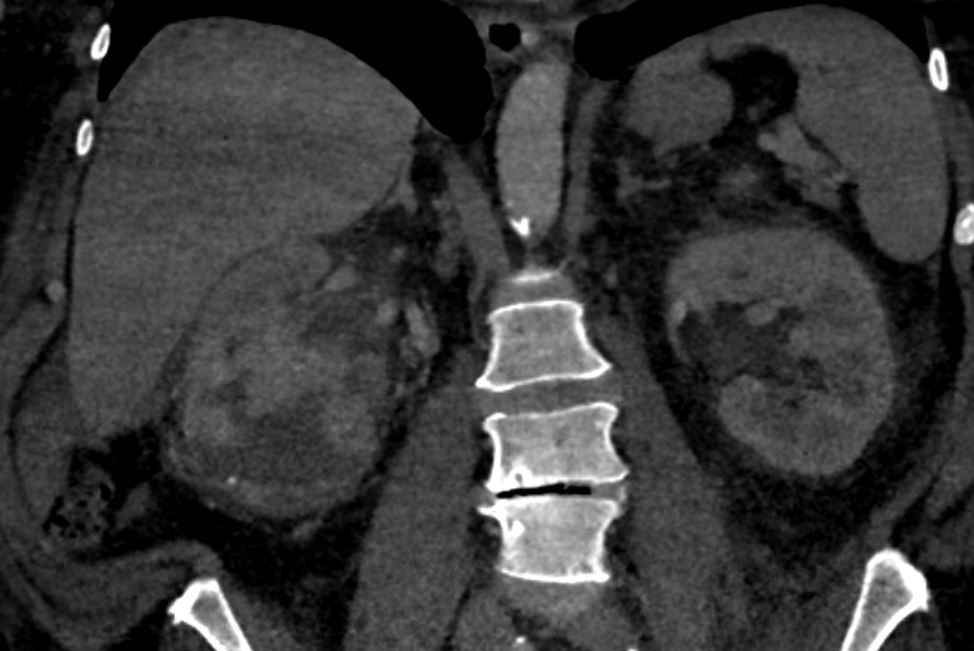 University of Arizona VIR tweet media