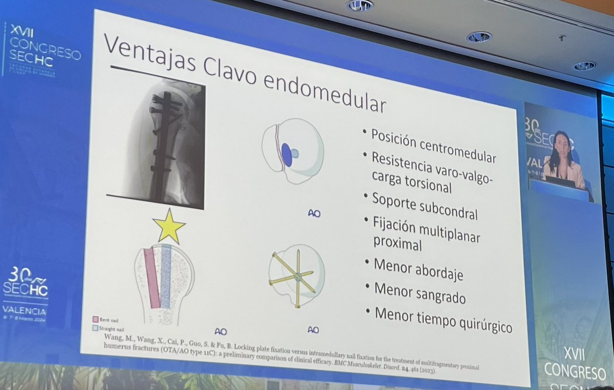 COTLaFe's tweet photo. “Todo lo que necesitas es un clavo, mi indicación perfecta y cómo lo hago”, la interesante charla de la Dra. Nadia Jover  @NadiaJover en el XVII Congreso de la SECHC 👏🏻 https://t.co/IBN9PZWdix