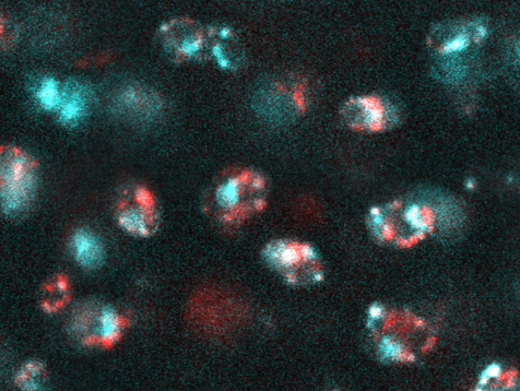 Bonassar Lab (@bonassarlab) on Twitter photo Congrats to Aiyana Fortin <a href="/FortinAiyana/">Aiyana Fortin</a> for being selected as a finalist for the 2024 SB3C Student Paper Competition! This work examines the intra-tissue and intra-cellular uptake and retention kinetics of Cā Dot nanoparticles for therapeutic applications in knee osteoarthritis. Congrats to Aiyana Fortin <a href="/FortinAiyana/">Aiyana Fortin</a> for being selected as a finalist for the 2024 SB3C Student Paper Competition! This work examines the intra-tissue and intra-cellular uptake and retention kinetics of Cā Dot nanoparticles for therapeutic applications in knee osteoarthritis.