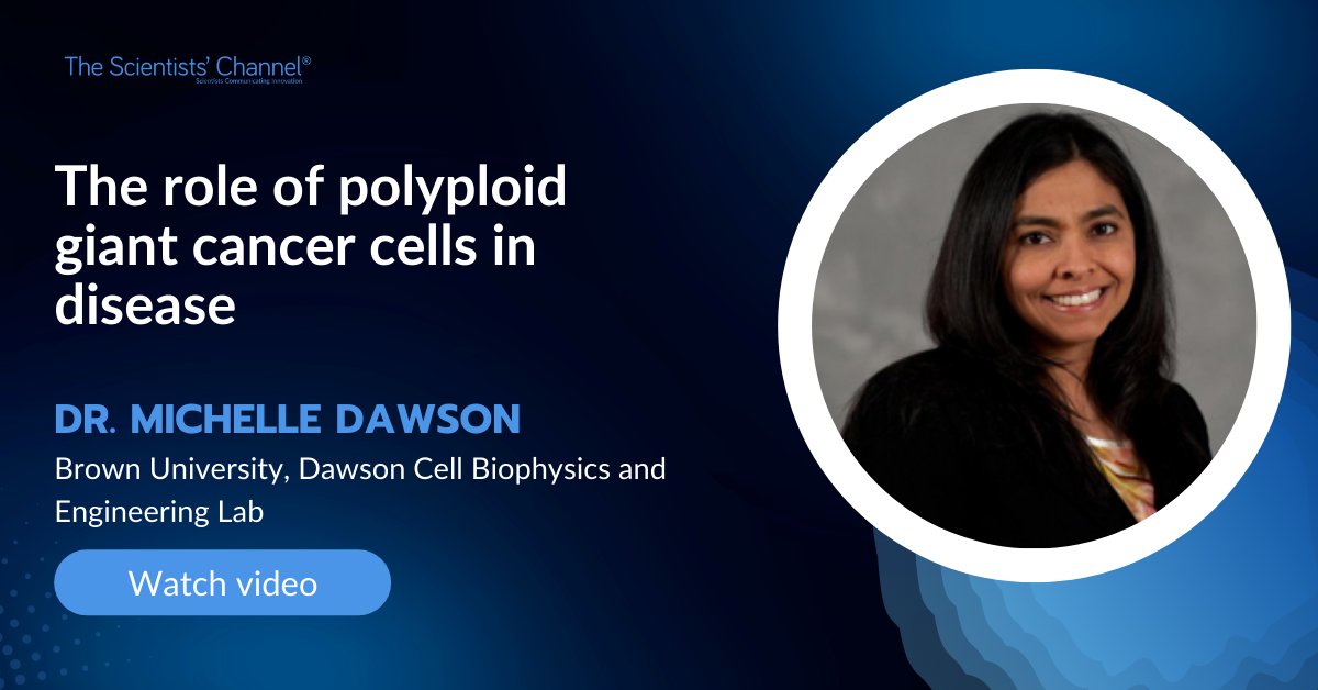 TheScientistsChannel (@thescientistsc) on Twitter photo Did you know that polyploid giant #cancer cells have unusual forms of replication? Understanding their interactions is crucial in determining how invasive cancers develop. Watch <a href="/DawsonStemCell/">Michelle R Dawson</a> share her #research on cell metabolism and interactions: bit.ly/3q40kQB Did you know that polyploid giant #cancer cells have unusual forms of replication? Understanding their interactions is crucial in determining how invasive cancers develop. Watch <a href="/DawsonStemCell/">Michelle R Dawson</a> share her #research on cell metabolism and interactions: bit.ly/3q40kQB