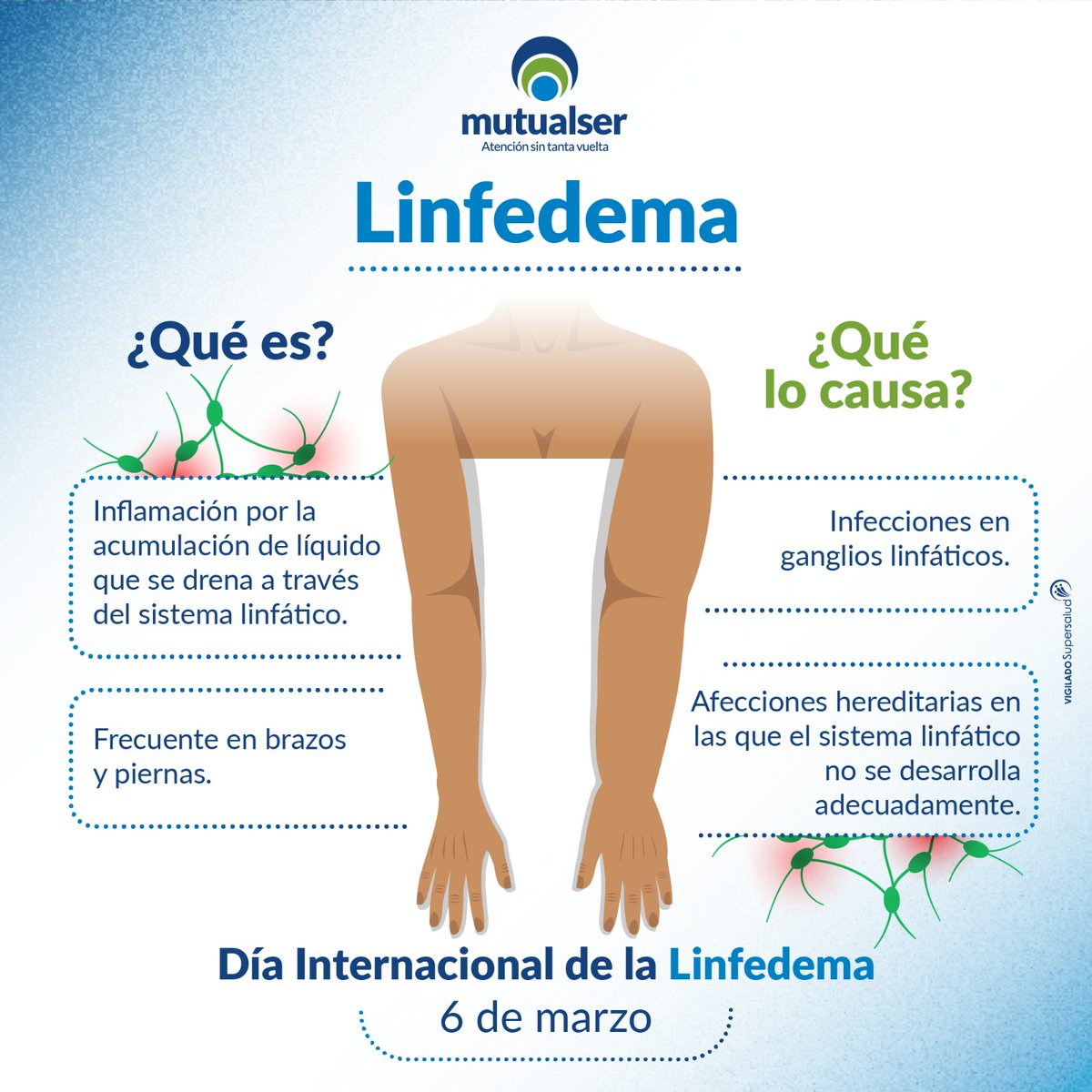 Hoy conmemoramos el Día Internacional de la Linfedema, dedicado a crear conciencia sobre esta condición que afecta a muchas vidas. #mutualser #mutualserepspensandoenti