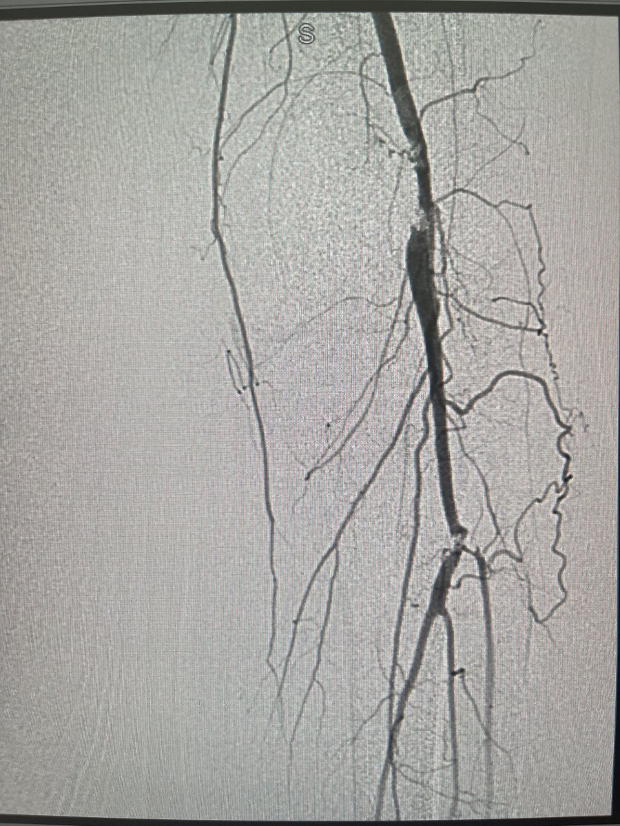 Arun Singh Kahlon, MD, FSCAI tweet media