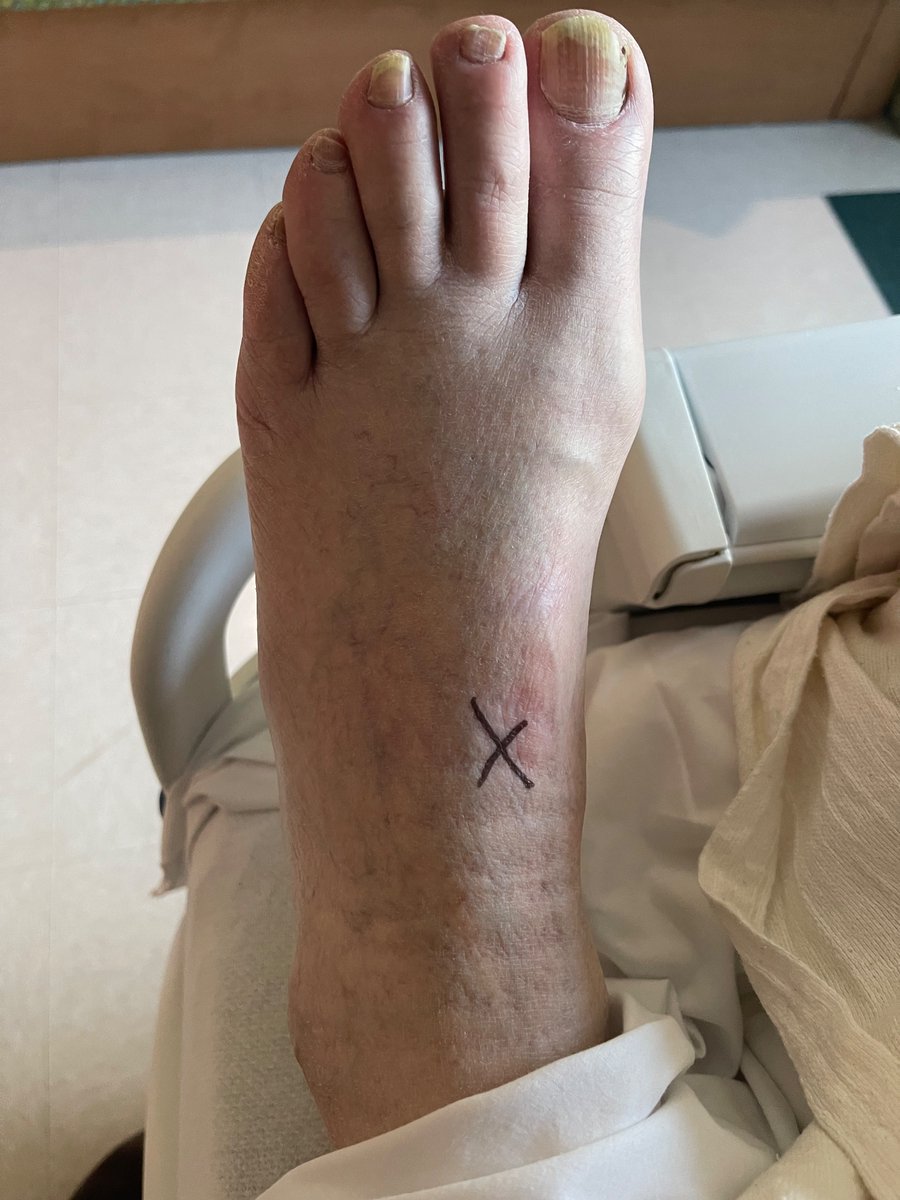 Arun Singh Kahlon, MD, FSCAI tweet media