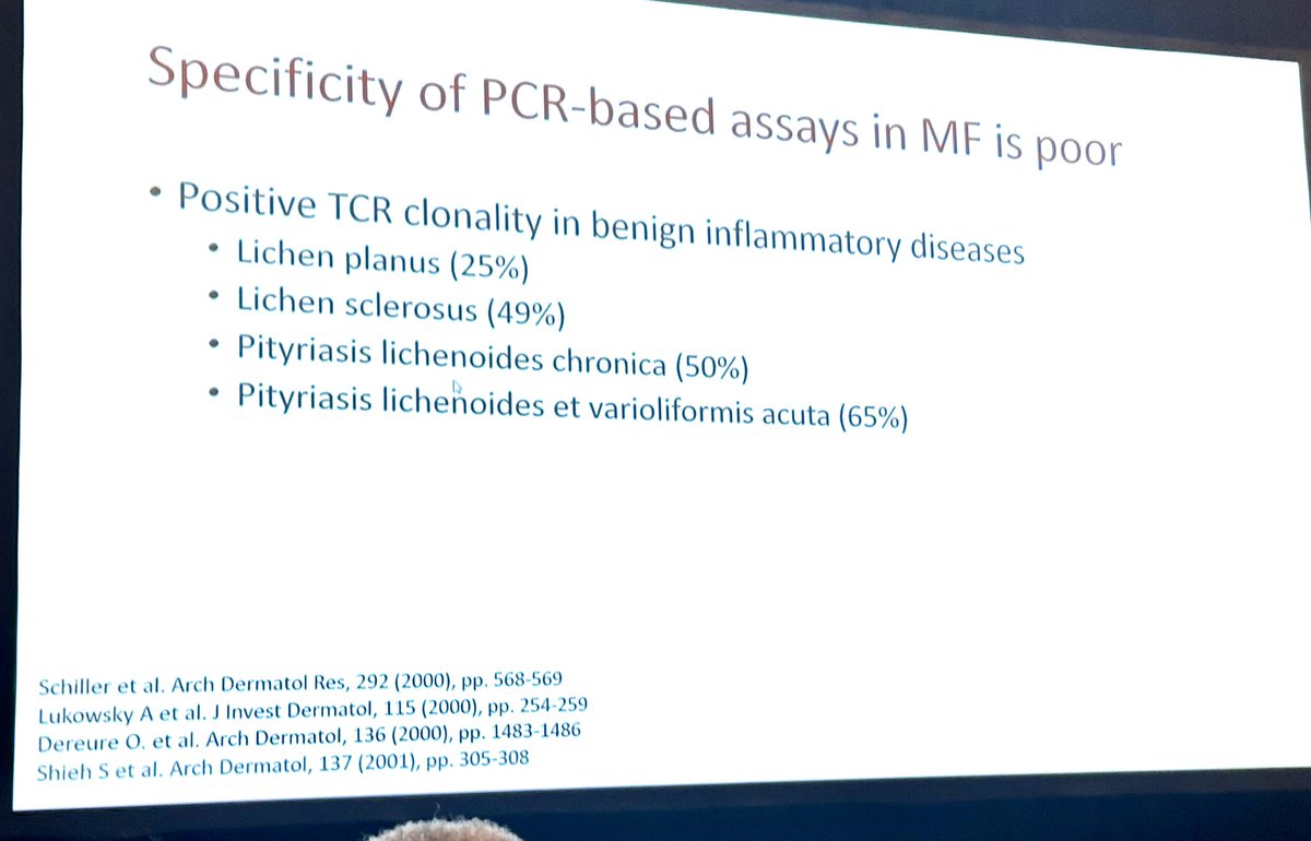 Be aware of the low specificity of clonal TCR rearrangement studied by PCR. NGS provides higher specificity and sensitivity #ISDPSanDiego <a href="/IntSocDermpath/">Int Soc Dermpath</a>