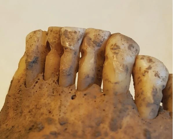 TeleLease's tweet photo. Discover how Viking dentistry practised over 1000 years ago was astonishingly advanced.
The British Dental Journal looked at a study published in the peer-reviewed open access journal PLoS One.
#dentalclinic #dentalpractice #equipmentfinance

https://t.co/nAyjXQib2f https://t.co/Zz7P2Fgkg9