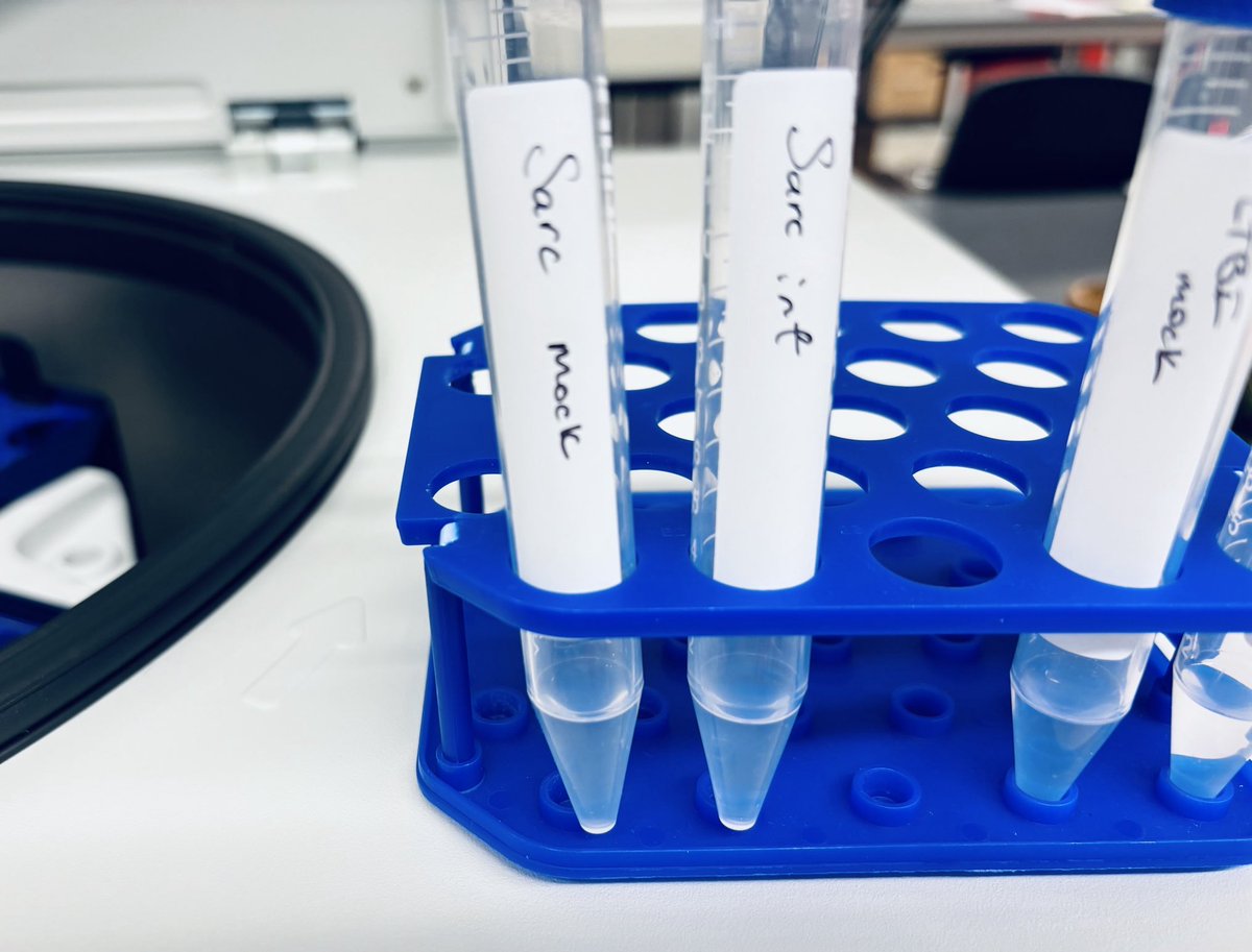 These little cell pellets represent so much work and promise for my first experience with single cell gene expression data! Hoping to gain insight into bacterial triggered immune cell function in #sarcoidosis #10x