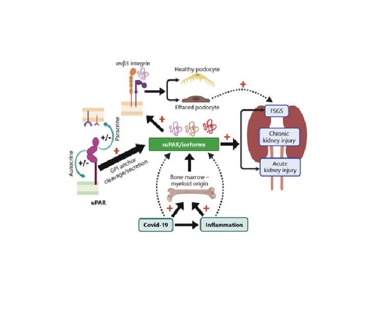 NephroKarger's tweet photo. 📣Highly cited in #Nephrology: suPAR: An Inflammatory Mediator for Kidneys

✍️ Yashwanth Reddy Sudhini, Changli Wei &amp; Jochen Reiser
🔗https://t.co/j2DkJD6Msa
📖 #KidneyDis

#NephTwitter #KidneyDisease #OpenAccess https://t.co/cdNFy9NUrM