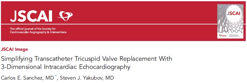 MyJSCAI's tweet photo. 📑💡Imaging is a critical component of the success of #TTVR. 🗣️Presented at #SIF2024 this article describes strategies &amp; techniques for the use of #3DICE as an adjunct to standard TEE during a TTVR procedure. #ICE

➡️https://t.co/xQ6ea7Pxmr 

 @caresans26 @StevenYakubov https://t.co/pfcsChUmBW
