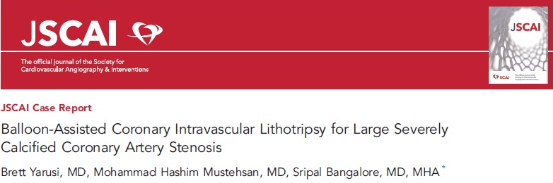 MyJSCAI's tweet image. 🆕📚 Presented at #SIF2024 💡case of recurrent #ISR due to severe coronary calcification w asymmetric stent expansion demonstrating the feasibility of #IVL along w a “buddy” balloon to treat stent eccentricity.

➡️doi.org/10.1016/j.jsca…

@MustehsanMD @SripalBangalore