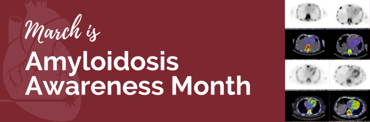 ctinocomesquita's tweet image. 🌟 #AmyloidosisAwareness 🌟

Did you know that Amyloidosis affects multiple organs, including the heart? Misfolded proteins deposit in tissues, causing damage. Cardiac Amyloidosis (CA) can lead to dysfunction and heart failure.
#HeartHealth #NuclearCardiology #HealthAwareness