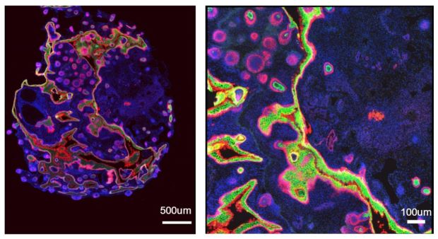 QLD researchers have used human stem cells to generate fully functioning skin tissue in a lab - a huge step towards better treatments for severe burns and wounds.

🔗brnw.ch/21wHDCv

<a href="/UQMedicine/">UQ Medicine</a> <a href="/shafiee_abbas/">Abbas Shafiee</a>

📸 A skin organoid stained with key human skin markers