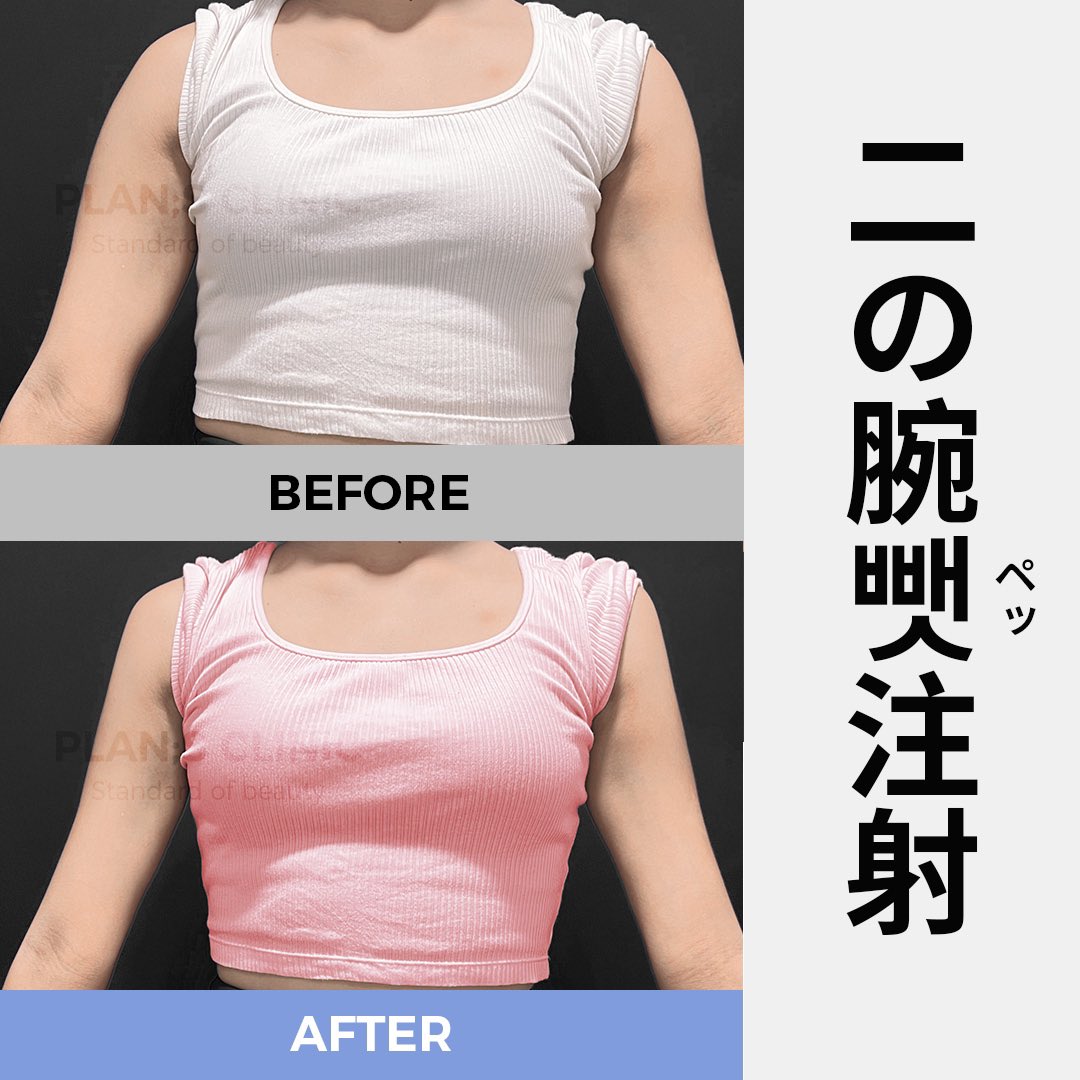 プランエスクリニック スキンケアサンプル プランエス クリニック