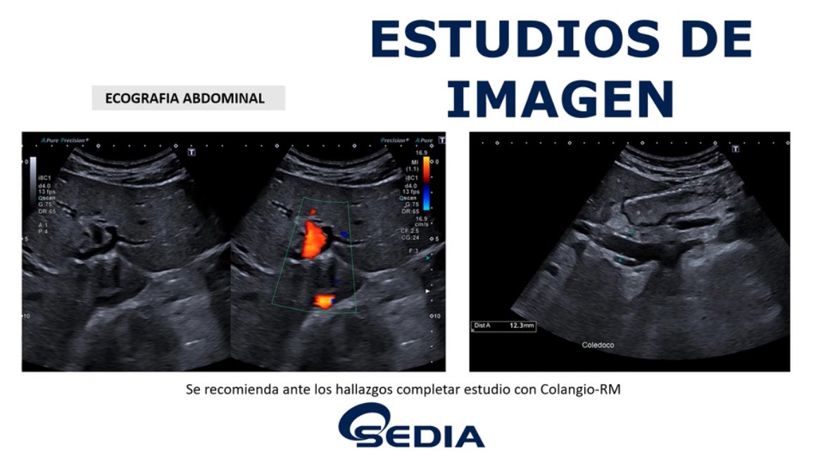 sediabdomen's tweet photo. Nuevo #casoSEDIA de marzo.
Si sabes la solución participa enviando tu respuesta a info@sedia.es.
Puedes verlo en https://t.co/sGWAdYfIww https://t.co/V7lyhGuC8q
