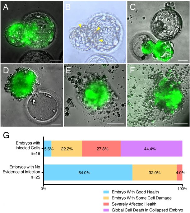 SARS-CoV-2 can INFECT HUMAN EMBRYOS (mega-thread) nature.com/articles/s4159… In this first study published end of 2022, they detected cases of infection that compromised embryo health.