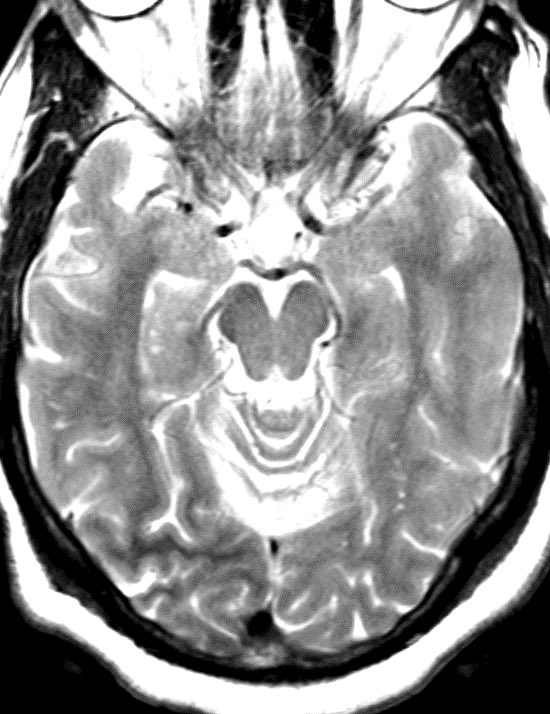 Daniel Gewolb, MD tweet media