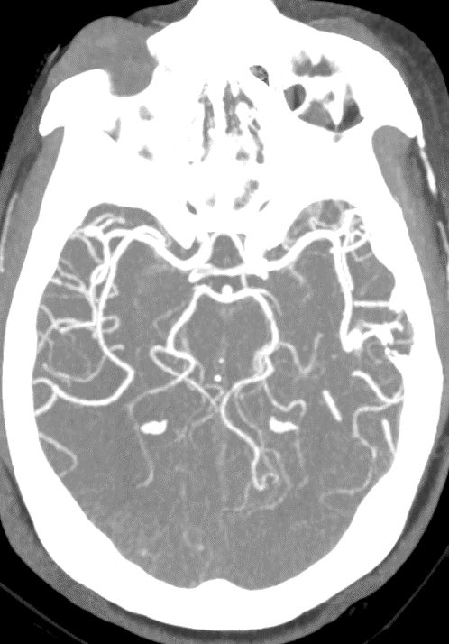 Daniel Gewolb, MD tweet media