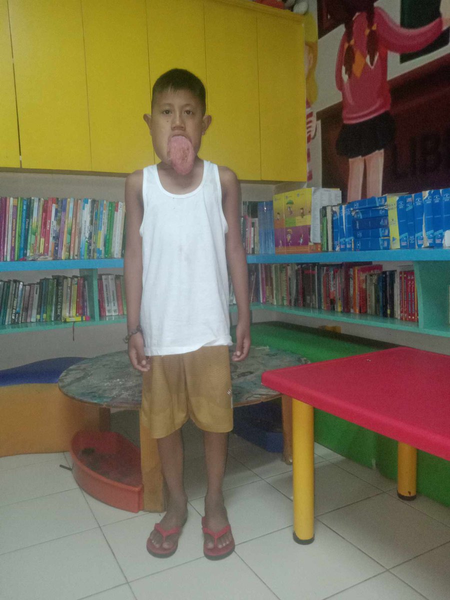 Update: Warrior Leo

They were back in Manila (from Isabela) and awaiting his checkup.  Currently staying at Child Haus. 
There is no date yet on when his surgery will be, for now he is also taking maintenance medicines. 

We will update for once he got his sirolimus test. Thank