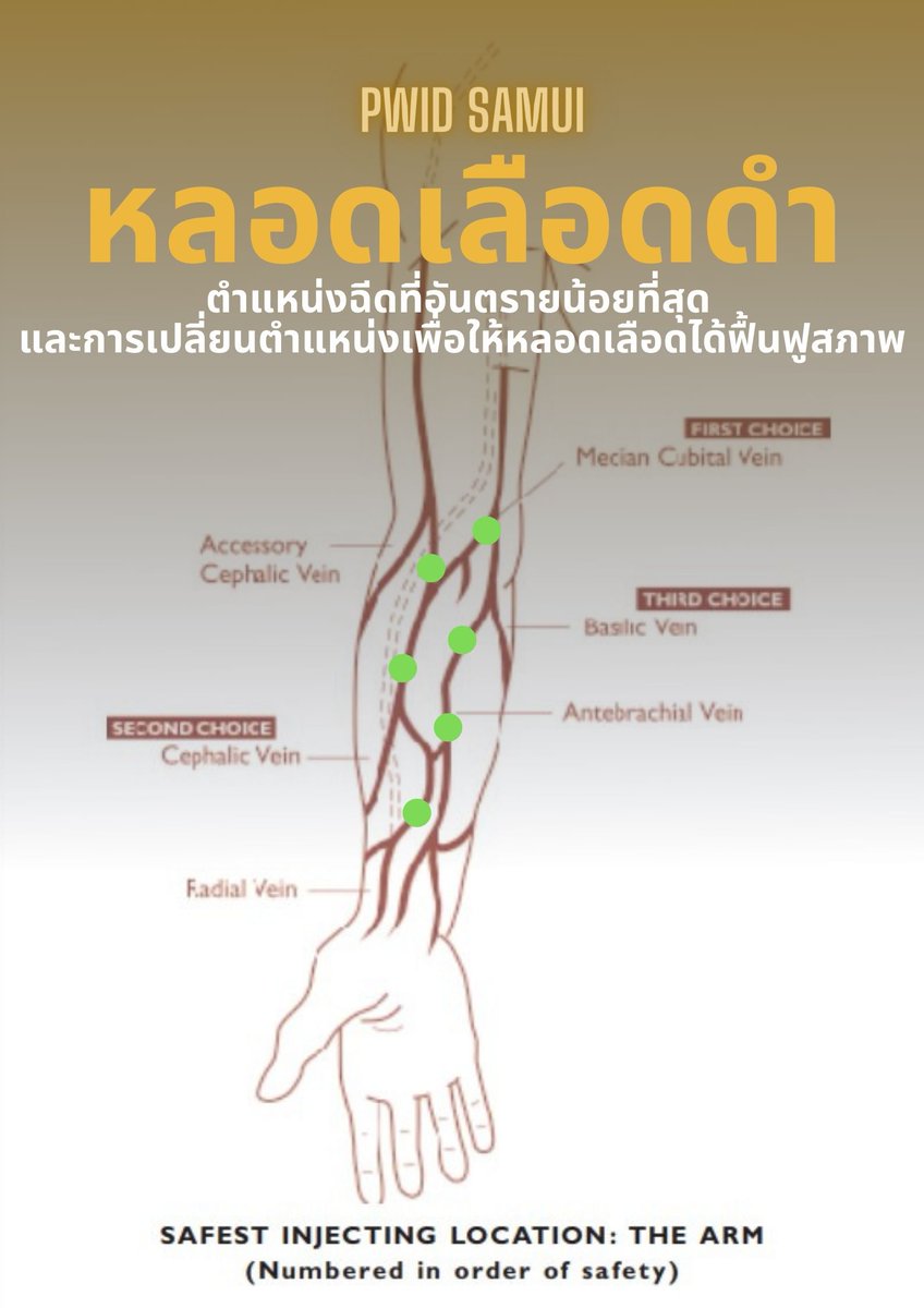 มีข้อมูล=ลดอันตราย แปลว่า ทำให้อันตรายน้อยที่สุด 
อยากได้เข็มใหม่ทัก 
#ลดอันตรายจากการใช้ยา #harmreduction #แชร์งานไม่แชร์เข็ม #ป้องกันHIV #ตรวจHIV #ไฮ #ไฮฉีด #ฉีด #บิน #เชื้อเพลิง #งาน #ไฮสมุย #ฉีดสมุย #นัดเย็ดสมุย #เกาะสมุย #สมุย