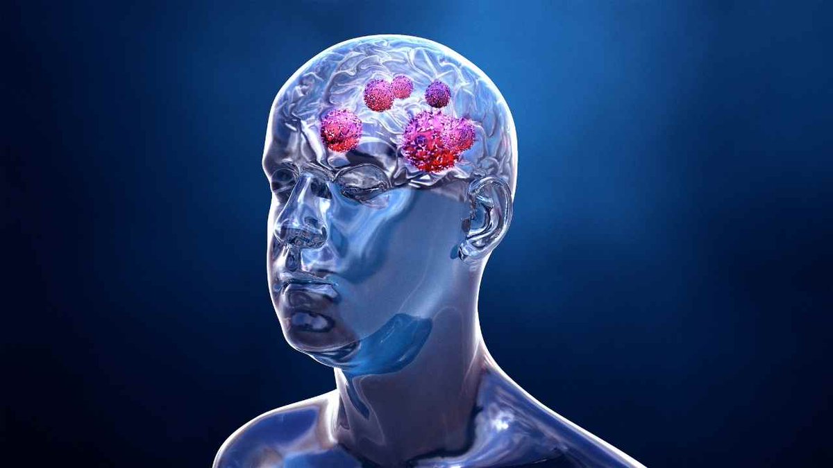 JofCancerPrev's tweet image. A brain tumor occurs when abnormal cells form within the brain. There are two main types of tumors: malignant tumors and benign tumors.
Visit us for information: lnkd.in/e5gdVa3U
#brain #tumor #abnormal #cells #headaches #seizures #melignant #vision