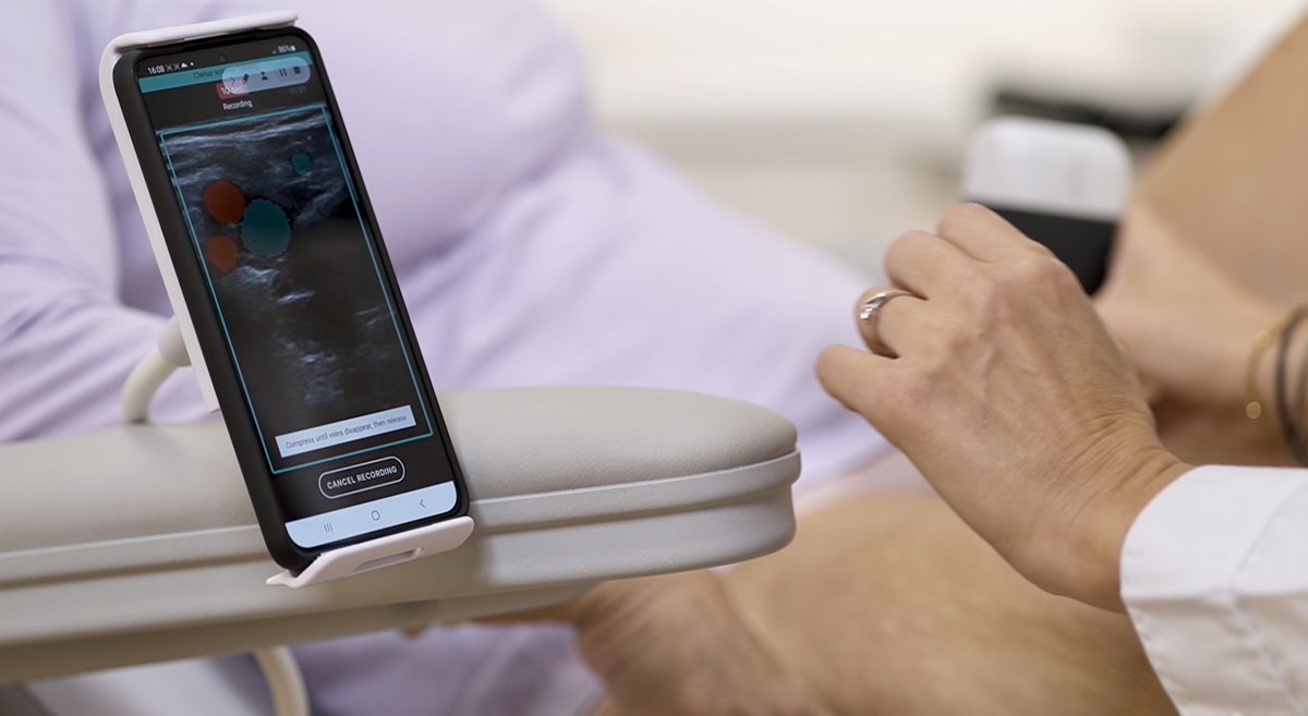 Could AI (artificial intelligence)-guided point-of-care ultrasound help diagnose #DeepVeinThrombosis in #PrimaryCare? Postgraduate researcher & PhD student, Kerstin Nothnagel (@KerstinSaupe) is investigating. Find out more: ➡️ aipocus.blogs.bristol.ac.uk @GPCareUK @ThinkSono
