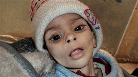 MustafaBarghou1's tweet photo. 700,000 Palestinians are starving in Gaza. 20 of them died from starvation up-till now https://t.co/kOzZ9R7jgE