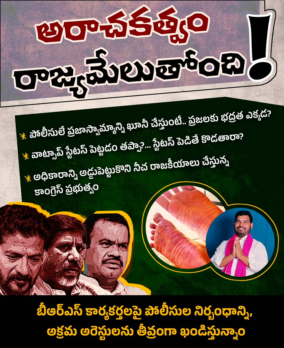 BRSparty's tweet photo. కాంగ్రెస్ పాలనలో అరాచకత్వం రాజ్యమేలుతోంది! వాట్సాప్ స్టేటస్ పెట్టినందుకు బీఆర్ఎస్ పార్టీ కార్యకర్తను కొట్టిన పోలీసులు.  

బీఆర్ఎస్ కార్యకర్తలపై పోలీసుల నిర్బంధాన్ని, అక్రమ అరెస్టులను తీవ్రంగా ఖండిస్తున్నాం. https://t.co/KZOAOqNhbk