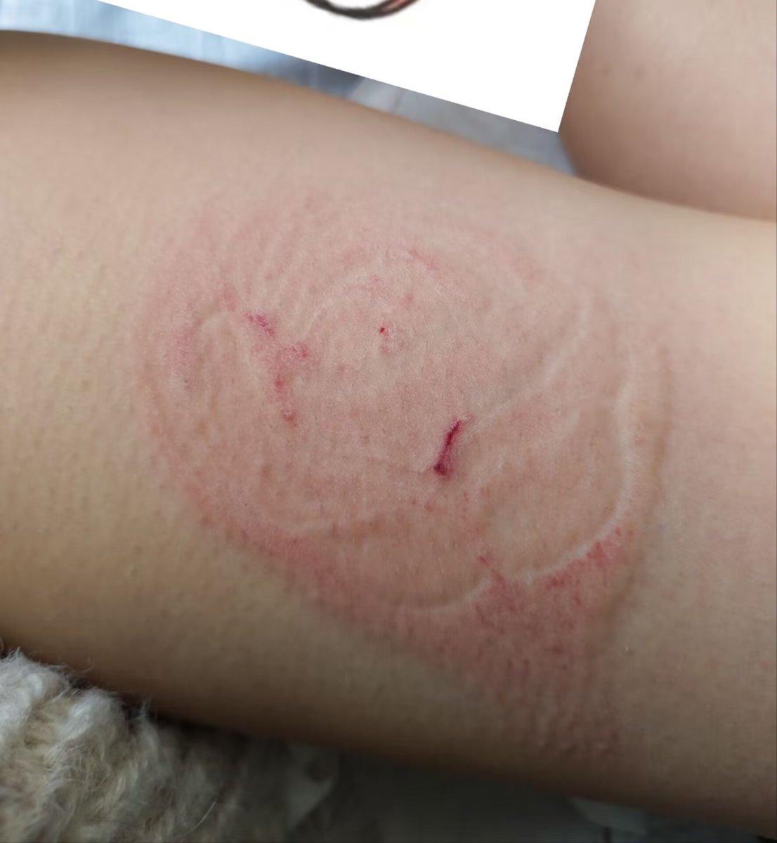 第一次印花 真的很疼呜呜呜呜但是后面好好看！喜欢