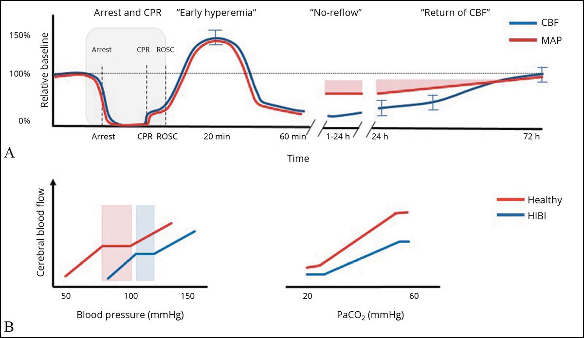 Today's Paper of the Day is on cerebral hemodynamics after cardiac arrest: implications for clinical management criticalcarereviews.com/latest-evidenc… Join us to read 1 paper per day and stay up-to-date as we cover the spectrum of critical care across 2024