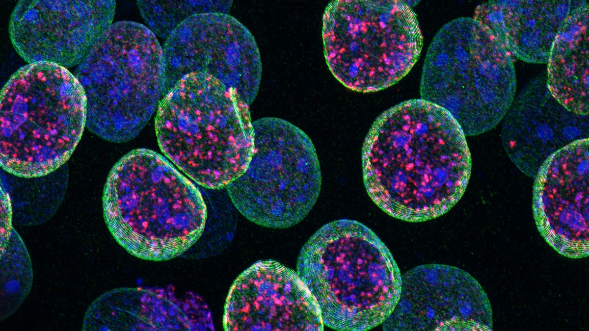 El @NeuroAlc determina el papel de una proteína para mantener la identidad de las neuronas. La identidad de una célula determina sus funciones, por lo que estudiar los mecanismos que la mantienen es clave para entender las enfermedades neurodegenerativas.➡️tiny.cc/y3hfxz