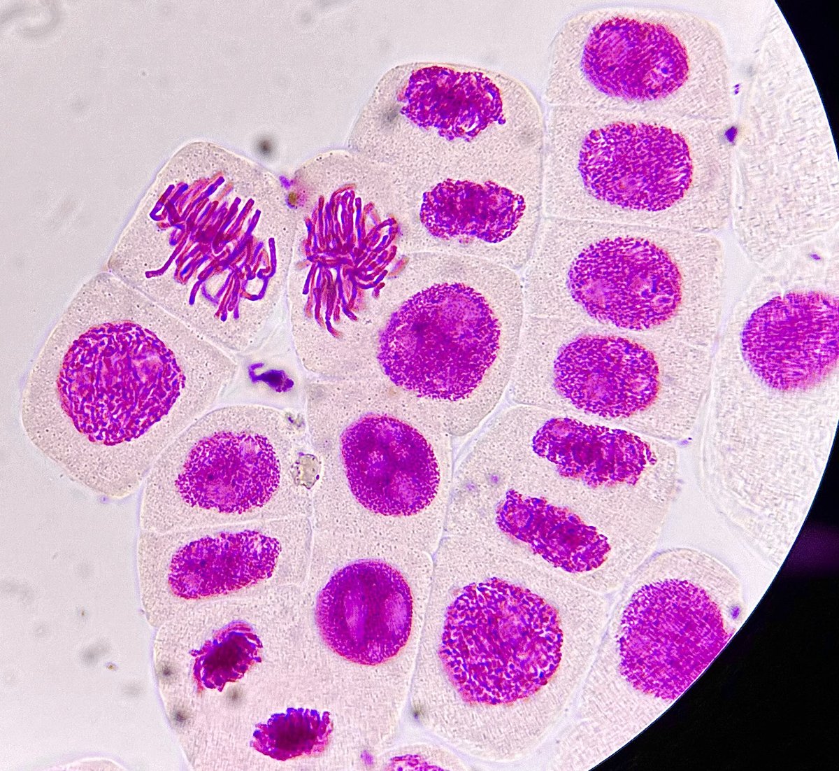 UoWBioSci's tweet image. Cells measure time with the cell cycle clock. ⏰A repeating pattern of events tells cells when to grow and divide. This image from a first year practical shows cells in different stages of cell division. 🔬
#UoWBioSci #BritishScienceWeek #mitosis #cellcycle #chromosomes