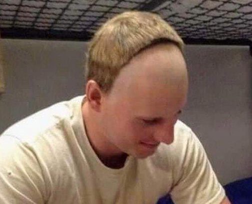 GardonDeLait's tweet photo. "#notbalding" https://t.co/Jdmc3yxFgk