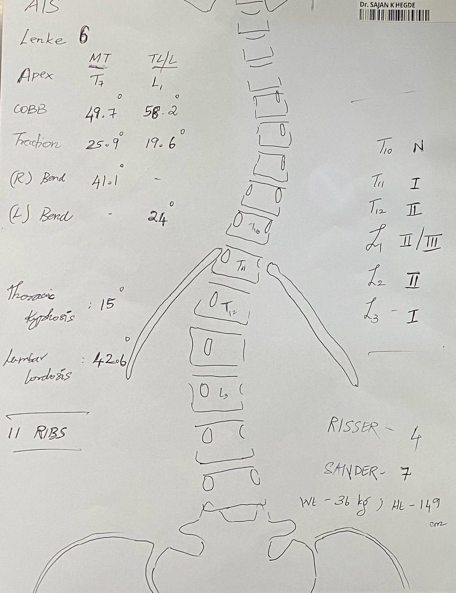 Another complex spinal case performed seamlessly by a true master of robotics workflow, non fusion surgical strategies and #ERAS protocols. It's really a pleasure to see this man #Sajan #Hegde and his team at work! Mesmerizing!!! <a href="/SRS_org/">Scoliosis Research Society</a> <a href="/Apollo_Chennai/">Apollo Hospitals, Chennai</a> <a href="/EANSonline50/">European Association of Neurosurgical Societies</a> <a href="/AOSpine/">AO Spine</a>