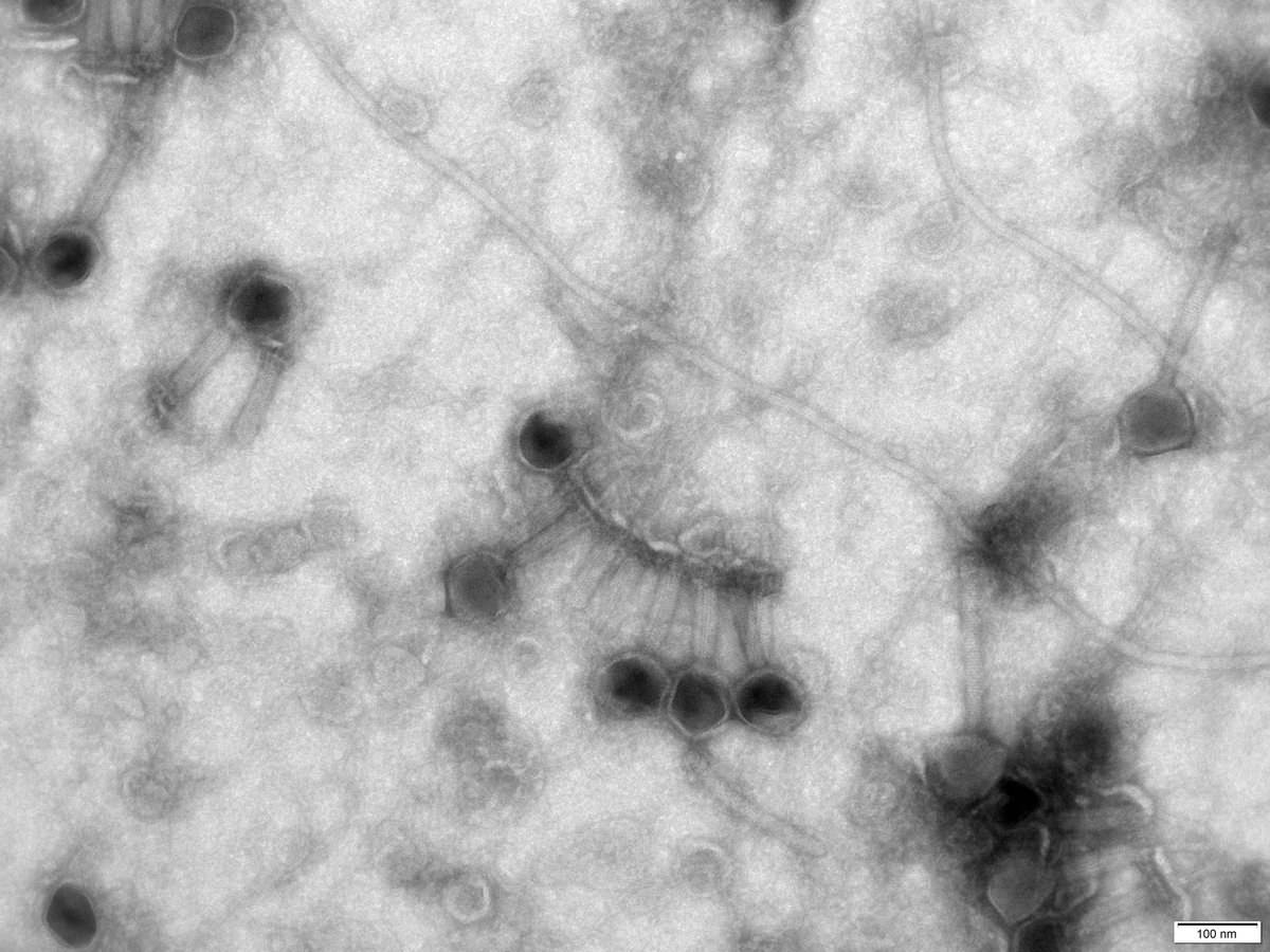 🔬✨Aquí una fotografía de nuestros fagos listos para marcar la diferencia en el tratamiento de infecciones bacterianas! En #EVOLVINGTHERAPEUTICS ofrecemos soluciones innovadoras. Únete a la FAGOrEVOLUCIÓN y contáctanos para más información! 💫#Salud #PhageTherapy 🌐