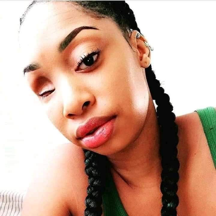 “In 2016, my brother stabbed me 5 times and I lost an eye as a result. He was under the influence of alcohol when it happened and it was a bad period in his life. I was in the hospital for a while (in a comatose state for 2 weeks).

 I woke up feeling very depressed but I knew I